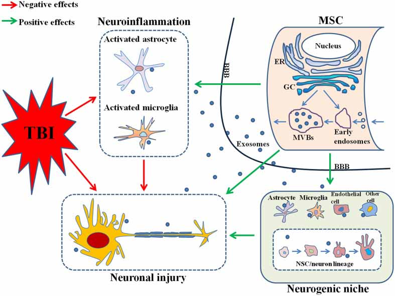 Neurodegeneration Traumatic Brain Injuri effects of exosomes
