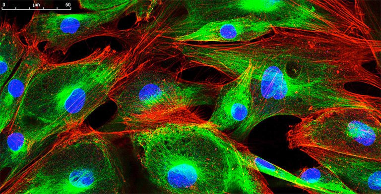 ANOVA IRM Deutschland - Immunfluoreszenzfärbung von Zellen