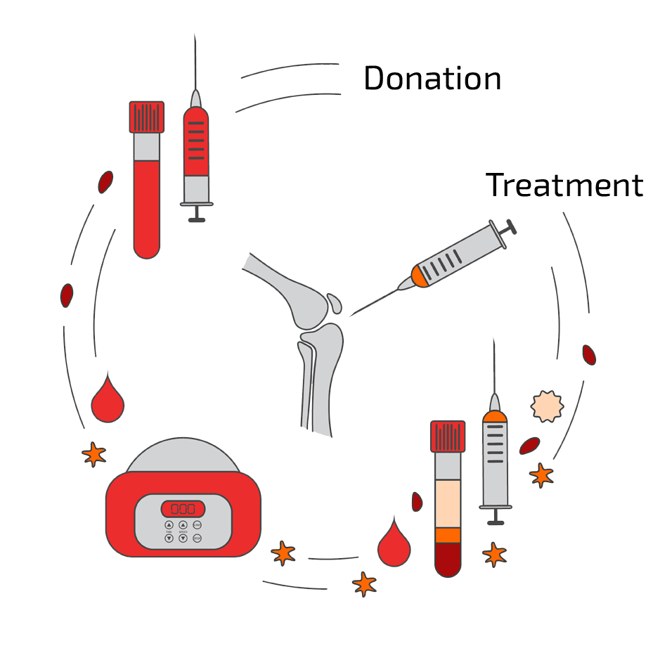 BMC-therapy-stem-cells-procedure | Germany