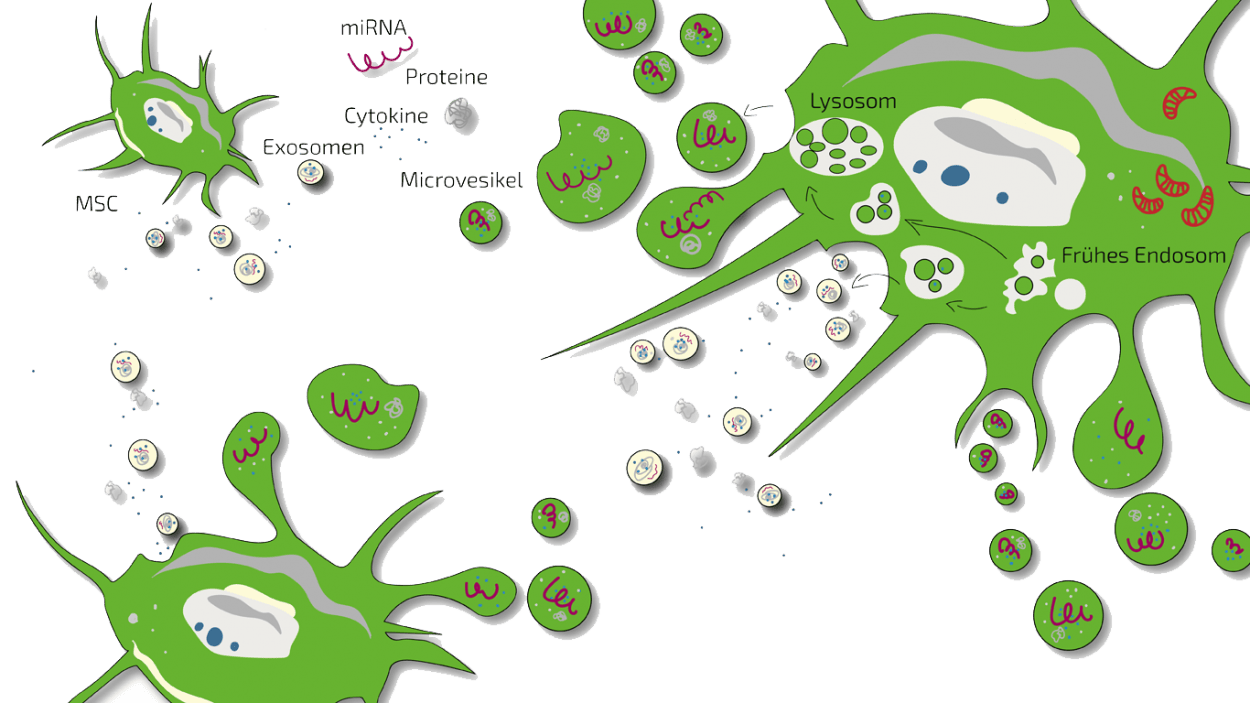 Stammzellen-Therapie-MSEC-Sekretom-Exosomen | ANOVA IRM