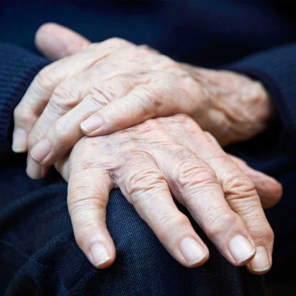 osteoarthritis