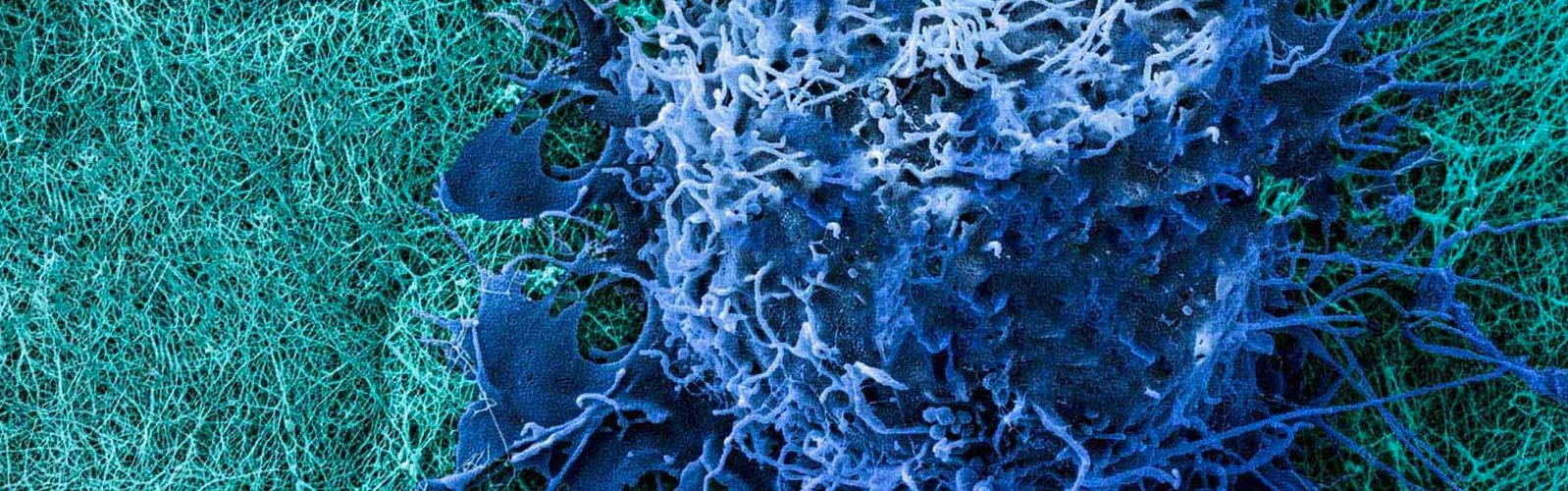 anova institute for regenerative medicine - bone marrow (BMC)